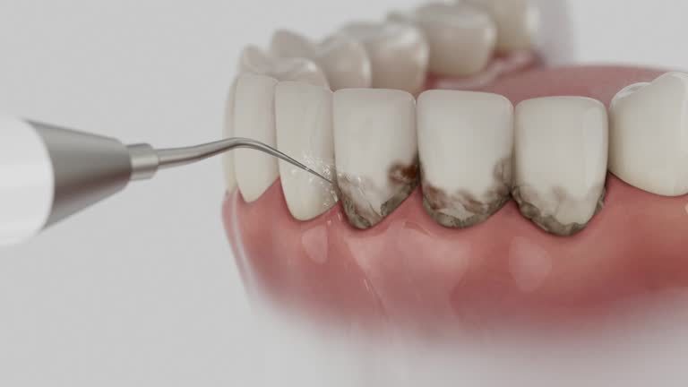 Trusted Dental Implants service in Garrett, WA - Dentist Open Now
